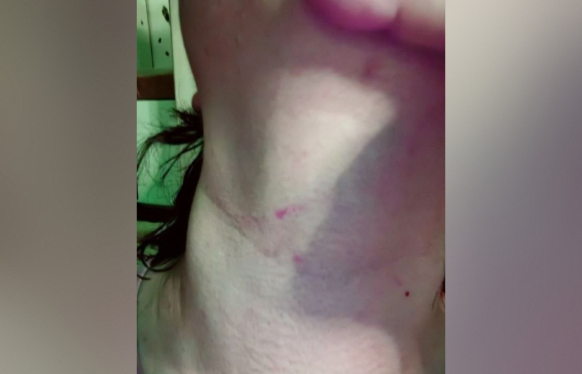 СК проверяет информацию о нападении на женщину в автобусе в Твери Фото: соцмедиа