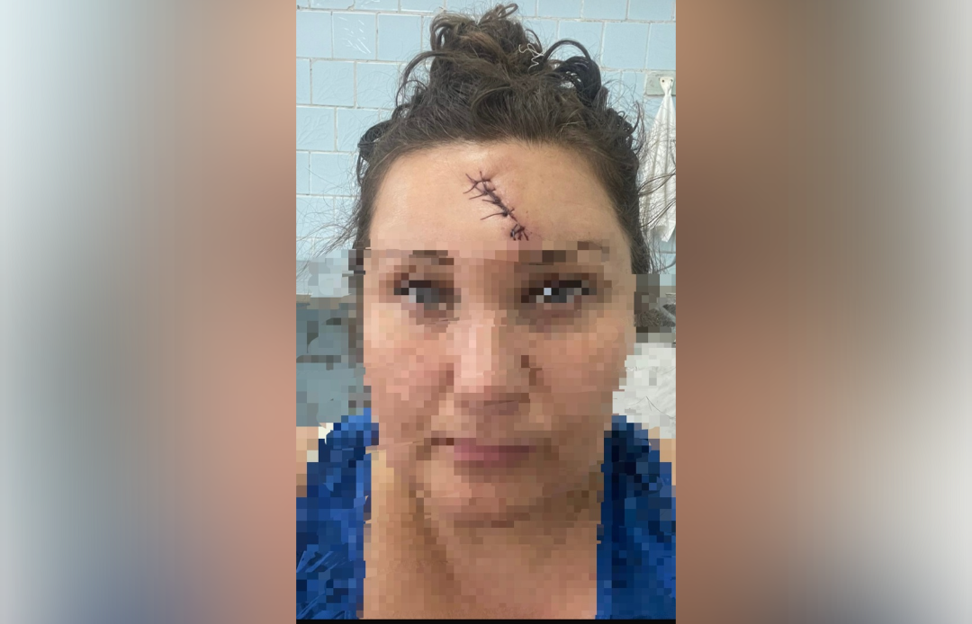 Опасное соседство: под Вышним Волочком женщину избили железной трубой за громкие разговоры Фото: Вышний Волочек - говорим и показываем