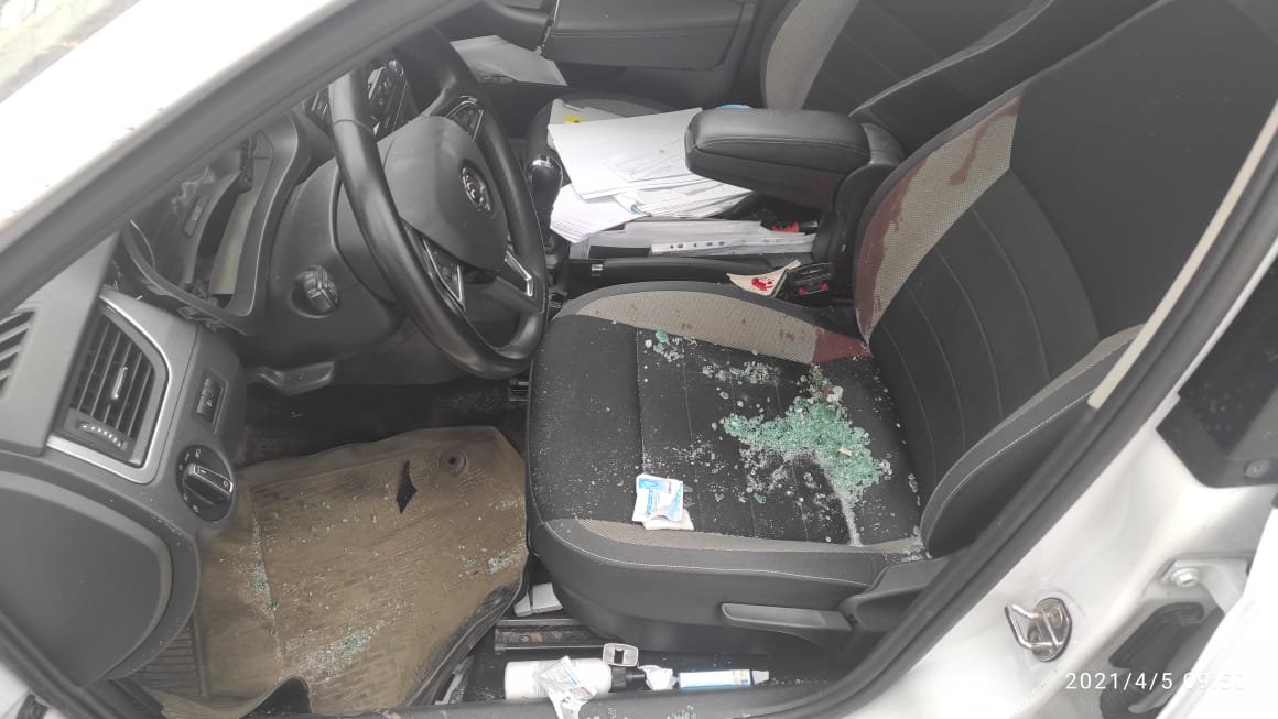 Обманул машину, но не себя: непристегнутый ремнем водитель легковушки получил тяжелые травмы в ДТП на Московском шоссе в Твери 