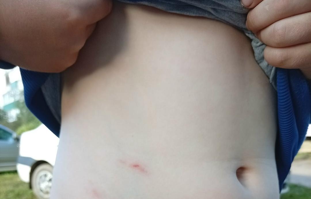 В Андреаполе Тверской области собака покусала ребенка Фото: https://vk.ru/publicandreapoli