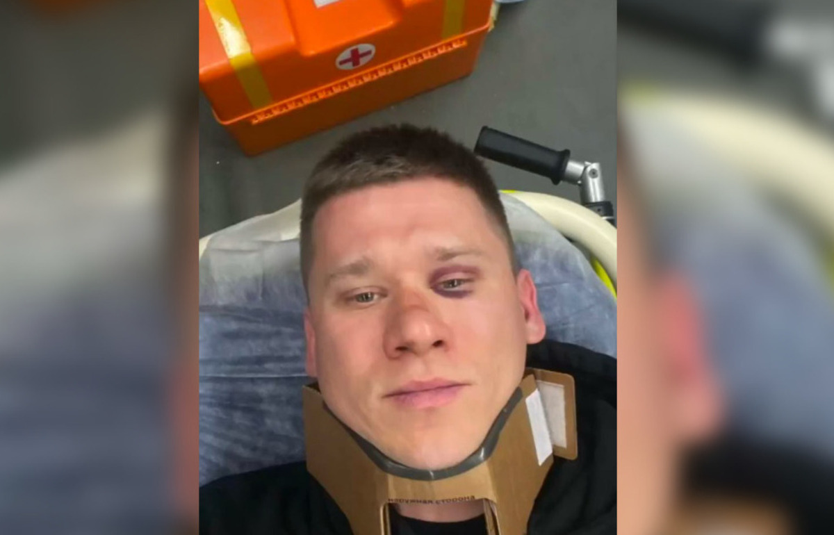 В Твери на улице Трехсвятской молодой человек стал жертвой агрессии
