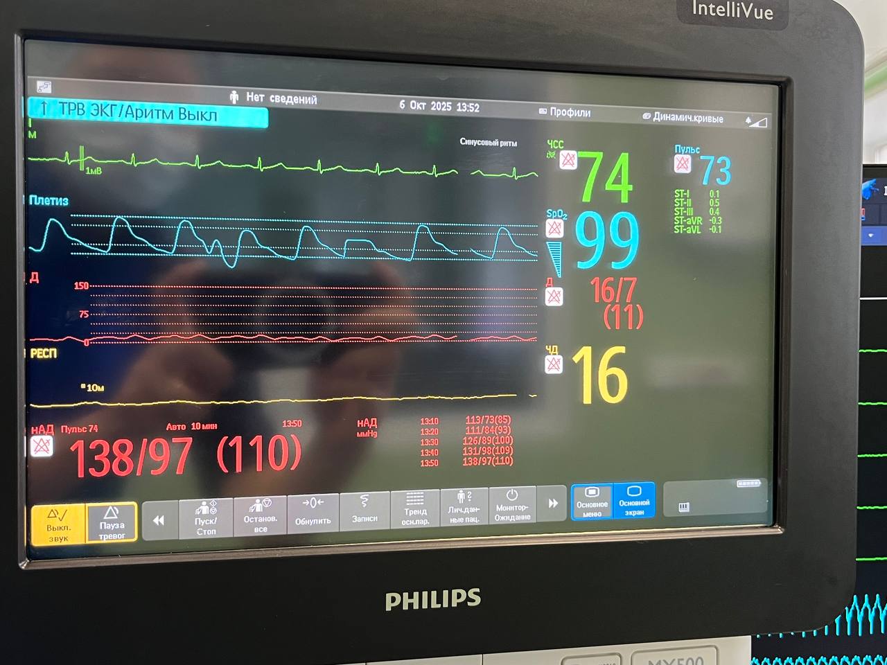 В Твери врачи Университетской клиники провели 14 высокотехнологичных операций  Фото: Тверской ГМУ