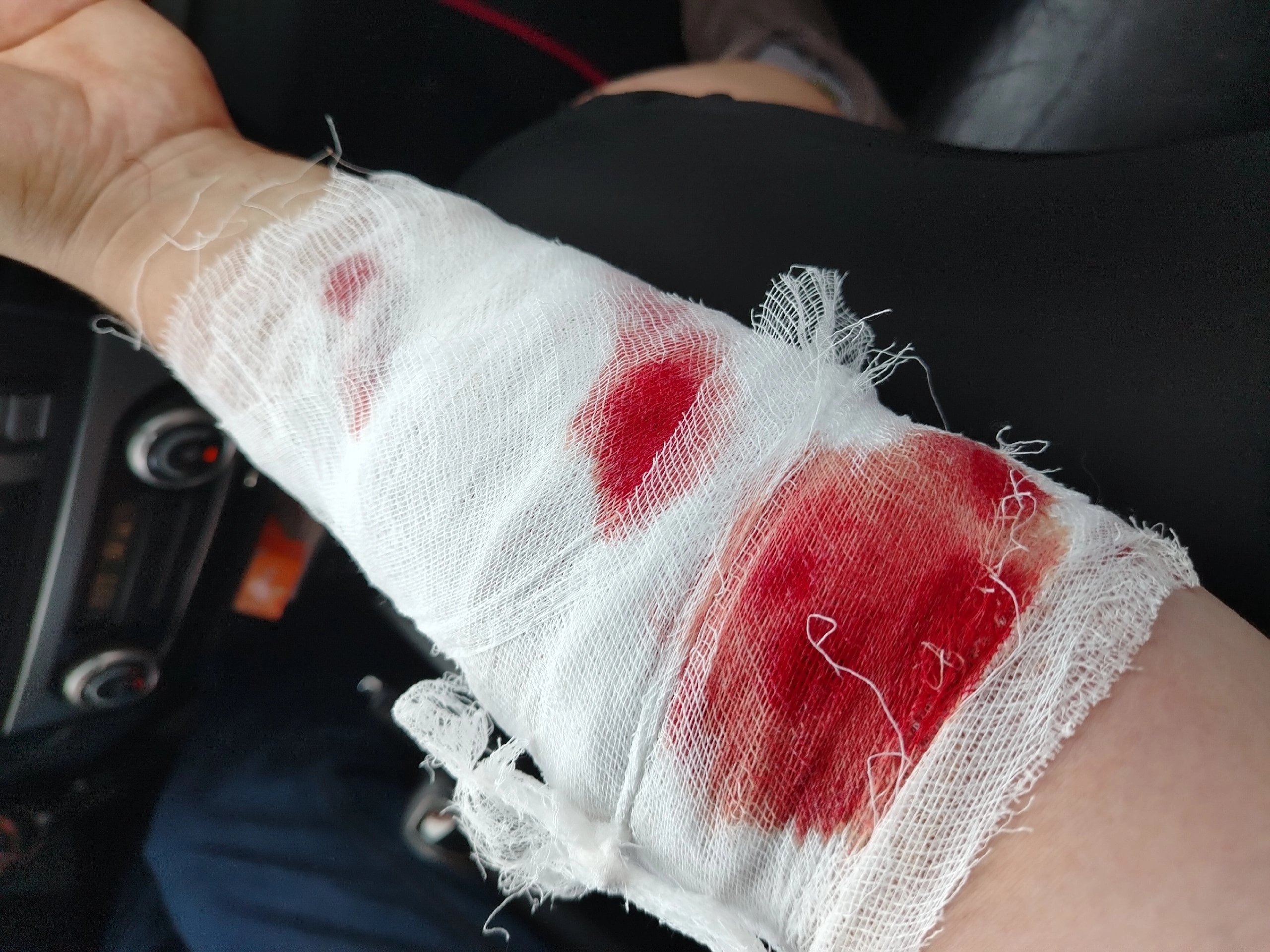 Под Тверью от нападения алабая пострадали уже девять человек - новости Афанасий