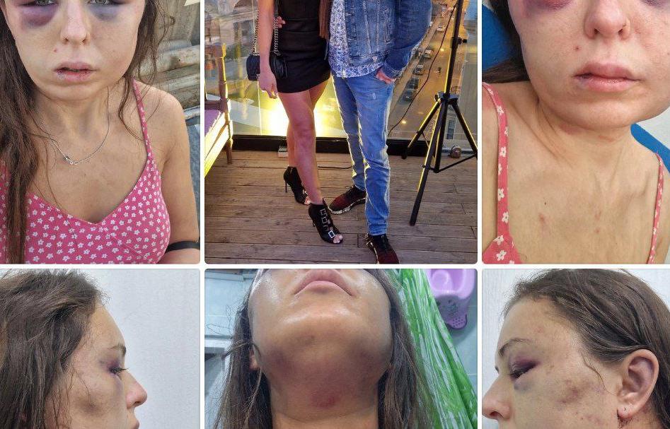 СК занялся делом жертвы избиения и сталкинга из Тверской области - новости Афанасий