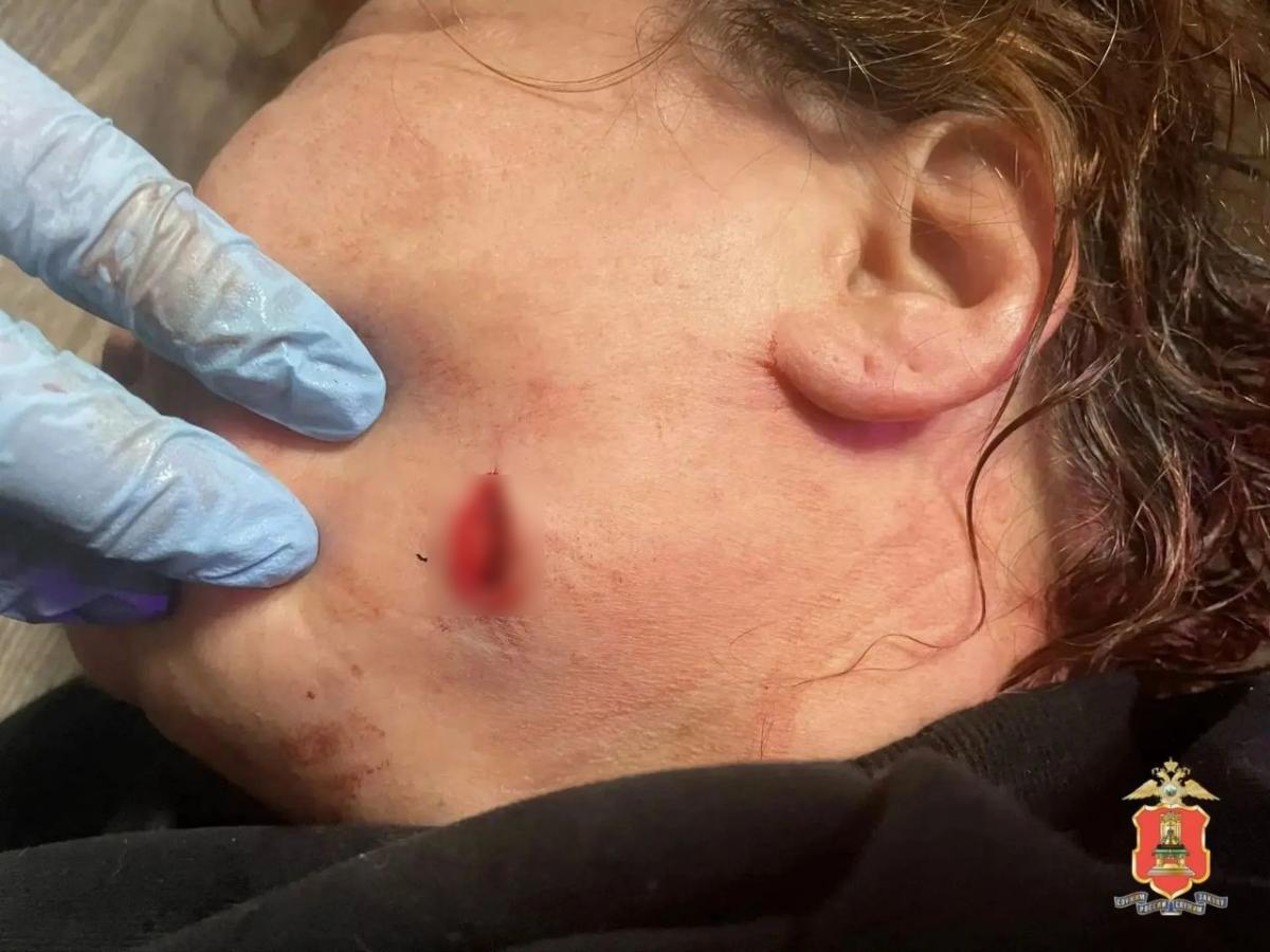 В Максатихе задержан мужчина, напавший с ножом на тещу Фото: УМВД Тверской области