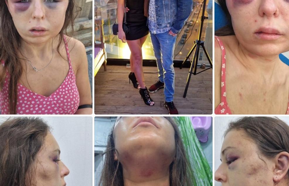 Полиция проверяет информацию об избиении жительницы Ржева - новости Афанасий