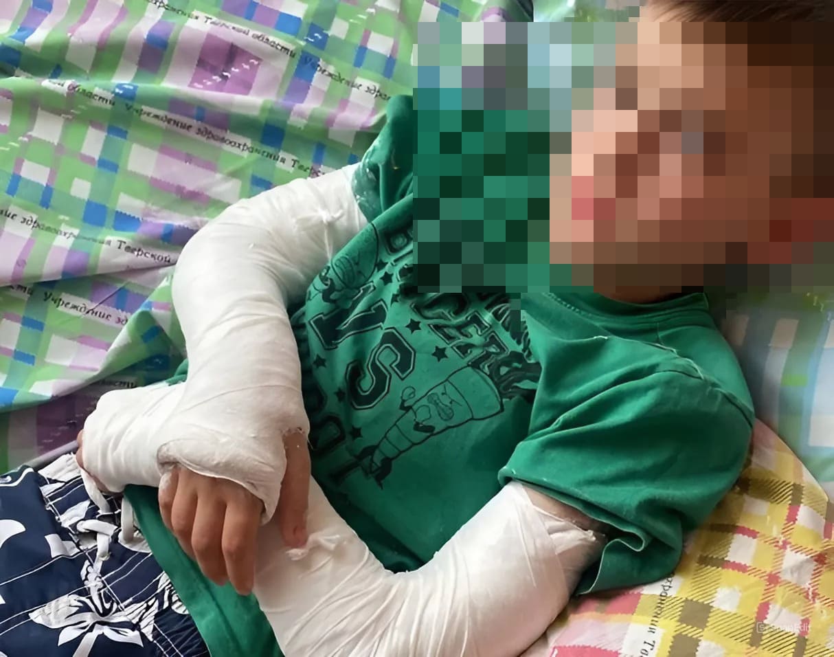 Под Тверью мальчик упал с турника и сломал обе руки Фото: 
ТИА