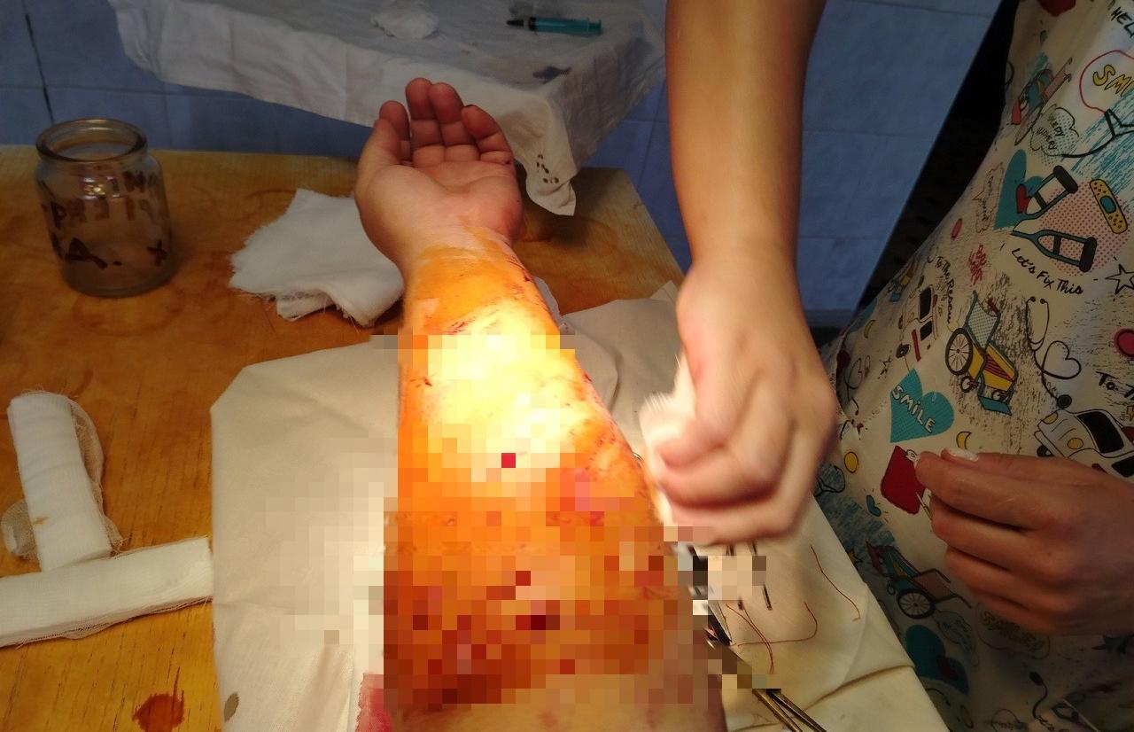 Бастрыкин взял на контроль проверку по факту нападения собаки на людей в Тверской области - новости Афанасий