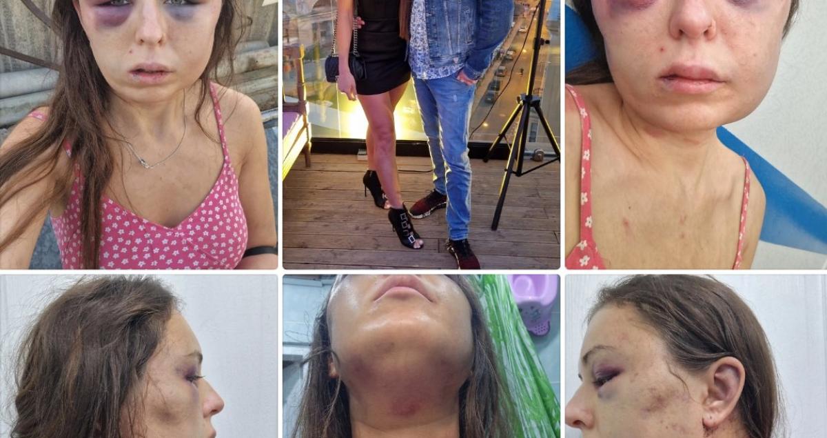 Полиция проверяет информацию об избиении жительницы Ржева Фото: соцмедиа