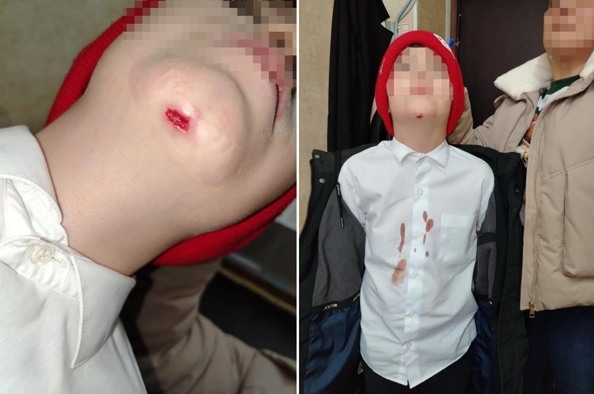 В Тверской области началась проверка после школьной драки в Вахонино Фото: соцмедиа