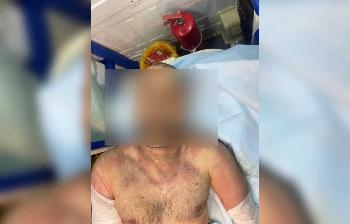 Установлена личность мужчины, найденного под Торжком без сознания  Фото: УМВД Тверской области