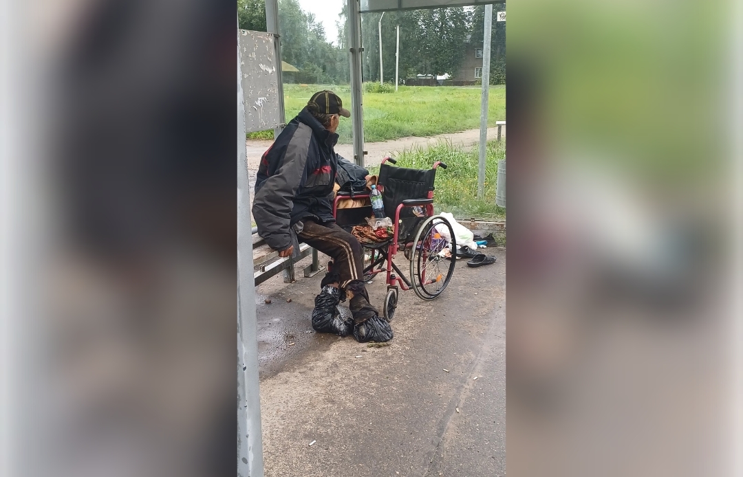 В Конаково ищут родных бездомного с больными ногами