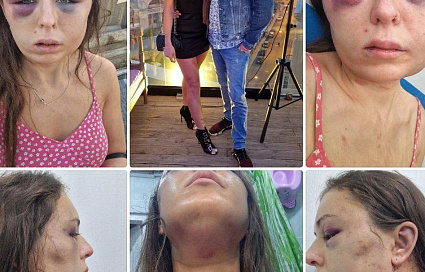 СК занялся делом жертвы избиения и сталкинга из Тверской области - новости Афанасий