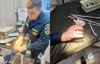 Жителя Старицы спасатели освободили от кольца - новости Афанасий