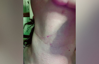 СК проверяет информацию о нападении на женщину в автобусе в Твери - новости Афанасий