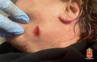 В Максатихе задержан мужчина, напавший с ножом на тещу - новости Афанасий