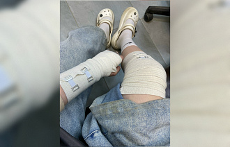 Девочка-подросток провалилась в люк в Кимрах - новости Афанасий